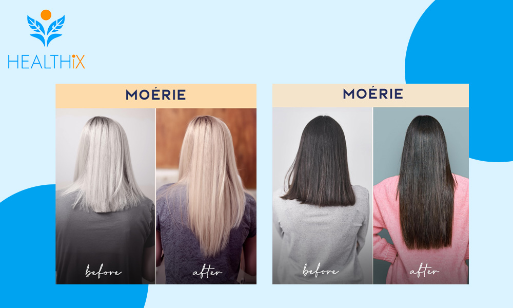 How do you use Moérie Ultimate Hair Growth Spray in the USA?